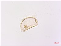 網脈雙蓋蕨藏品圖，第2張