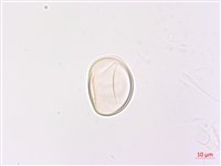 網脈雙蓋蕨藏品圖，第3張