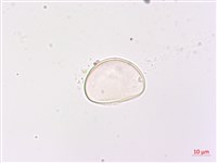 網脈雙蓋蕨藏品圖，第4張