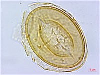 阿里山蹄蓋蕨藏品圖，第3張