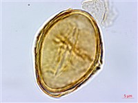 阿里山蹄蓋蕨藏品圖，第4張