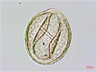 宿枝小膜蓋蕨藏品圖，第3張