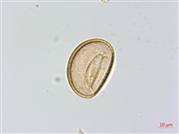 希陶蹄蓋蕨藏品圖，第2張