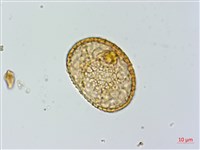 川滇蹄蓋蕨藏品圖，第2張