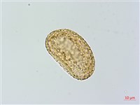 川滇蹄蓋蕨藏品圖，第4張