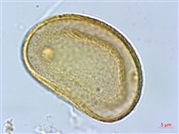 褐色短腸蕨藏品圖，第2張