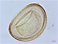 褐色短腸蕨藏品圖，第3張