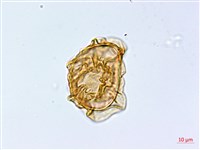 大理峨眉蕨藏品圖，第3張