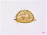 日本狗脊蕨藏品圖，第2張