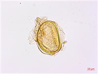 日本狗脊蕨藏品圖，第3張