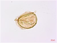 日本狗脊蕨藏品圖，第4張