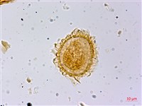 光葉軸脈蕨藏品圖，第3張