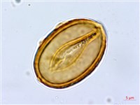 華東安蕨藏品圖，第4張