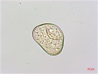 闊葉鱗蓋蕨藏品圖，第3張