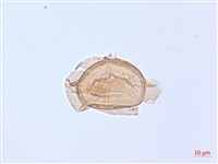 厚葉雙蓋蕨藏品圖，第4張