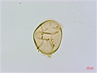 闊葉短腸蕨藏品圖，第3張