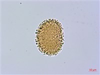 禾稈亮毛蕨藏品圖，第2張