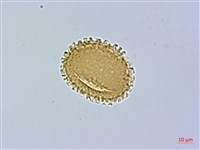 禾稈亮毛蕨藏品圖，第3張