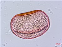 東方狗脊蕨藏品圖，第2張