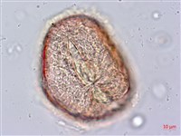 東方狗脊蕨藏品圖，第4張