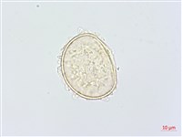 單葉雙蓋蕨藏品圖，第2張