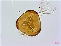 細毛碗蕨藏品圖，第2張