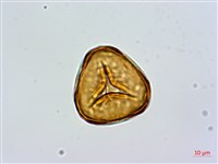 細毛碗蕨藏品圖，第4張