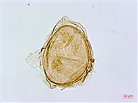 薄蓋短腸蕨藏品圖，第4張