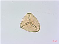 乳頭鳳丫蕨藏品圖，第3張