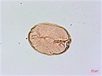 乳頭鳳丫蕨藏品圖，第4張