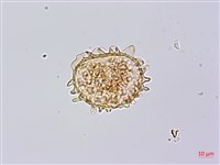 單葉雙蓋蕨藏品圖，第2張