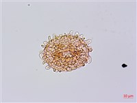 單葉雙蓋蕨藏品圖，第3張