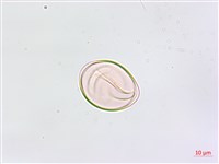 縮羽鐵角蕨藏品圖，第4張