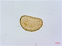 短葉蹄蓋蕨藏品圖，第2張