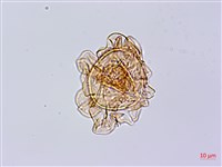 單葉雙蓋蕨藏品圖，第3張