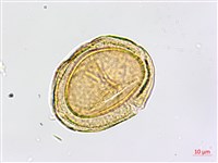 蘭嶼鐵角蕨藏品圖，第4張