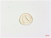 黃腺羽蕨藏品圖，第3張