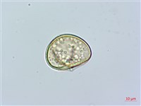 虎克氏鱗蓋蕨藏品圖，第3張