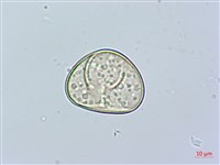 虎克氏鱗蓋蕨藏品圖，第4張