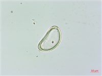 雙扇蕨藏品圖，第2張