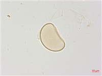 高山蹄蓋蕨藏品圖，第2張