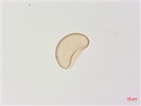 高山蹄蓋蕨藏品圖，第3張