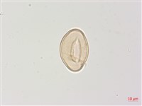 高山蹄蓋蕨藏品圖，第4張