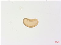 姬蹄蓋蕨藏品圖，第2張