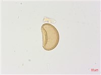 姬蹄蓋蕨藏品圖，第3張