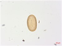 姬蹄蓋蕨藏品圖，第4張