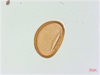 假軸果蹄蓋蕨、毛軸蹄蓋蕨藏品圖，第2張