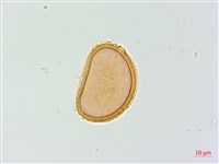 假軸果蹄蓋蕨、毛軸蹄蓋蕨藏品圖，第3張