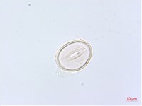 網脈雙蓋蕨藏品圖，第2張