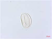 網脈雙蓋蕨藏品圖，第3張